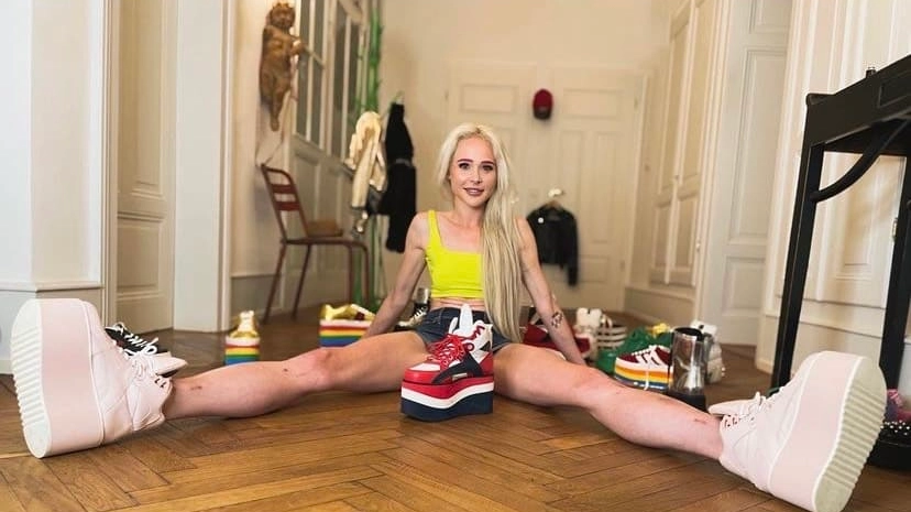 Theresia Fischer, la modella tedesca che si è fatta allungare le gambe di 14 centimetri per accontentare il suo marito (Instagram)