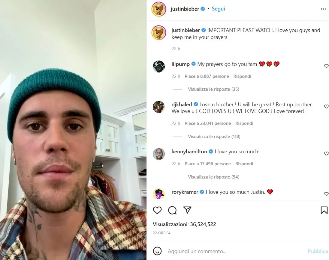 Justin Bieber su Instagram: "Ho la sindrome di Ramsay Hunt, metà volto è paralizzato"