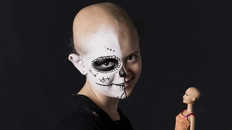 A Bologna una mostra dedicata dedicata all’alopecia areata