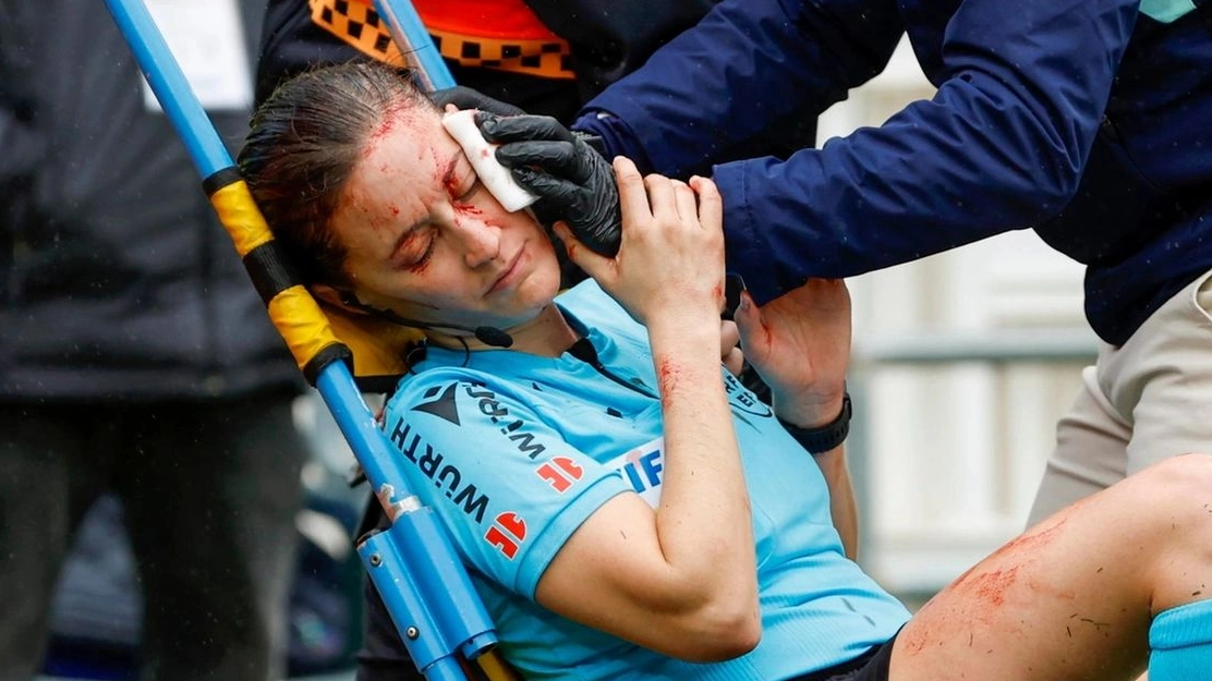 La guardalinee ferita alla testa durante la partita di calcio (Ansa)