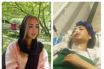 Iran, in coma e paralizzata dopo che la polizia le spara perché non indossa il velo mentre guida