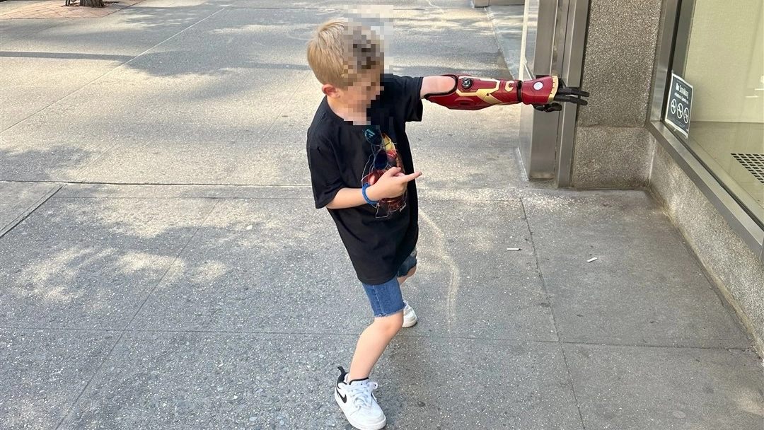 Jordan è il più giovane bambino con il braccio bionico da eroe