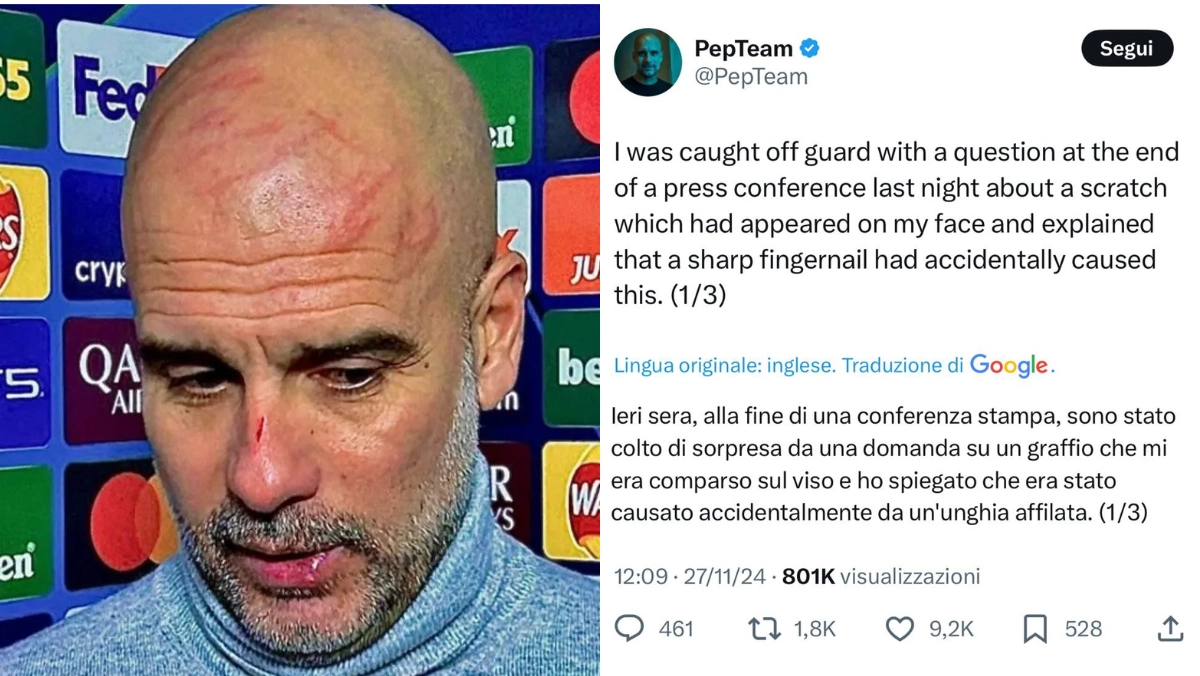 I graffi di Guardiola, autolesionismo? “Non volevo sminuire un problema serio”