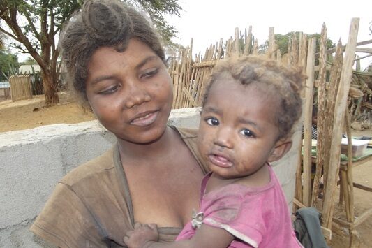 Tsaravolae is a 19-year-old mother of a one-year-old baby named Rovasoa. Tsaravolae is a single mother. Tsaravolae is still living with her parents, Nerake (father, 58) and Voatsazoe (mother, around 45), as well as her siblings in Ambovombe in Southern Madagascar.
She participates in daily activities for her family by mainly collecting and selling water, but she also sells cooked sweet potatoes. The family business is in a very bad condition. Tsaravolae works hard but doesn’t earn much. Even though she must work most of the day, she can afford only one meal a day. She sometimes receives money from the father of her daughter, like last week.
She hopes a more successful life in the future by finding a more profitable commercial activity to support herself and her daughter.


“I am Tsaravolae. I am 19 years old, the eldest daughter of my parents. I have eight siblings. I have a one-year baby. Her name is Rovasoa.
“I can’t live alone so I am still with my parents here in Ambovombe and I help daily my family on finding and selling water. I also sell cooked sweet potatoes because it is the season now. I don’t earn too much money, for example I take six pieces of sweet potatoes from the seller for 1 000 Ariary (roughly $0.25) and the send all for only 1 300 Ariary (around $0.33). However, it is better than nothing at all because I have to feed my baby. We frequently have one meal a day.
“A year ago, I met the father of Rovasoa. I get pregnant but we are not married nor are we living together. He lives now in another region. Sometimes he sends money to me. For example, last week I receive 20 000 Ariary (around $5) from him through my mobile money.
“I hope in the future to have more money. I don’t know precisely how but may be by developing my own business, a more prosperous commercial activity, so I can better take care of my child.”