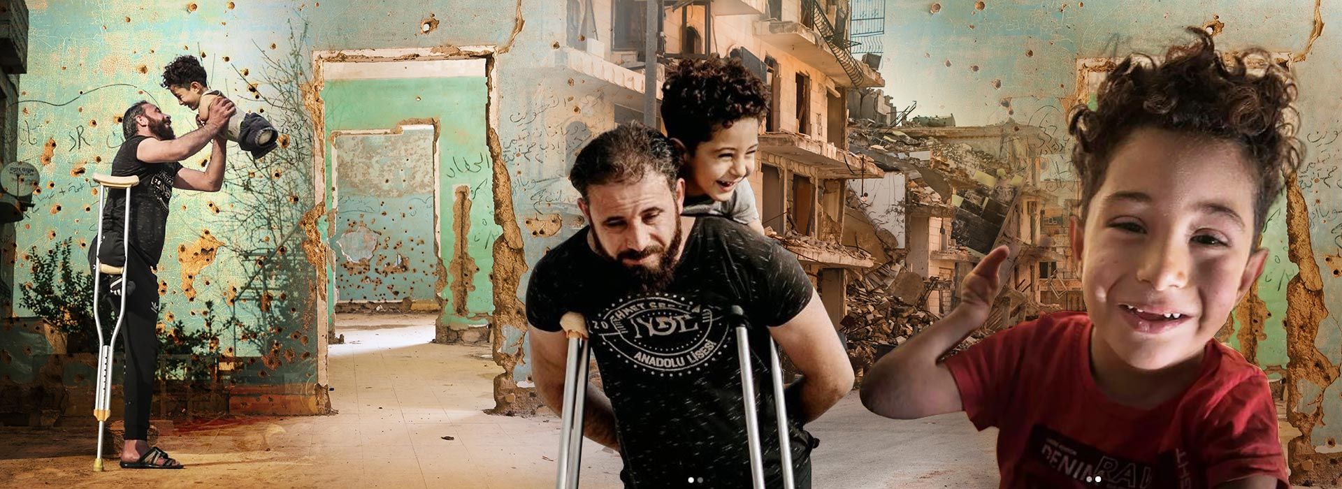 Mustafà bambino siriano senza braccia