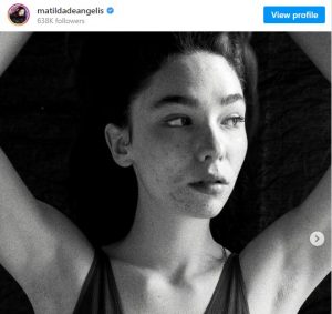 A marzo del 2021 Matilda De Angelis ha postato una sua foto che mostrava i segni dell’acne