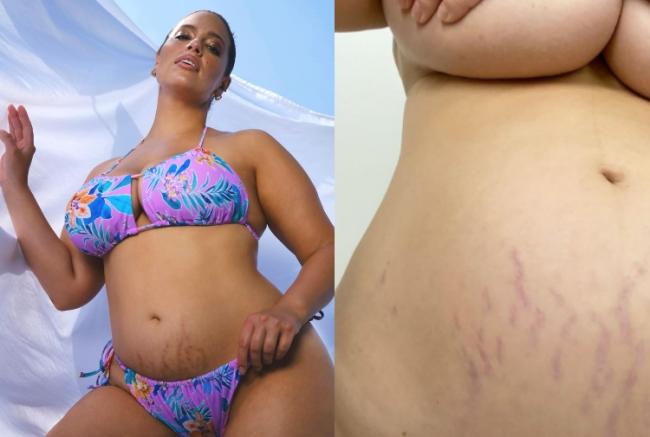 Ashley Graham, plus size model and champion of body positive a shot on Instagram in which she highlights the stretch marks on the belly
