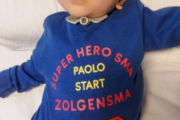Il piccolo Paolo, 2 anni, ha iniziato la terapia col farmaco Zolgensma