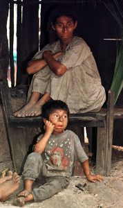 In Honduras il tasso di mortalità infantile è molto alta per malnutrinizione e malattie tra cui tubercolosi e anemia