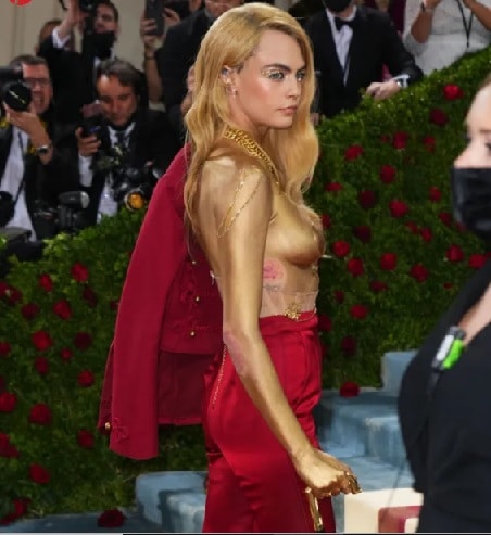 Cara Delevingne, 30 in August, suffers from psoriasis, and has decided to stop hiding it