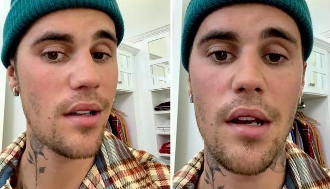 Justin Bieber (28 anni) su Instagram racconta di avere la sindrome di Ramsay Hunt e mostra, in un video di tre minuti, la sua impossibilità a muovere i muscoli facciali