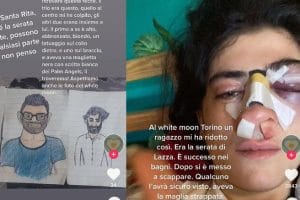 La foto postata da Ilenia, 20enne picchiata a Torino per aver difeso il proprio ragazzo