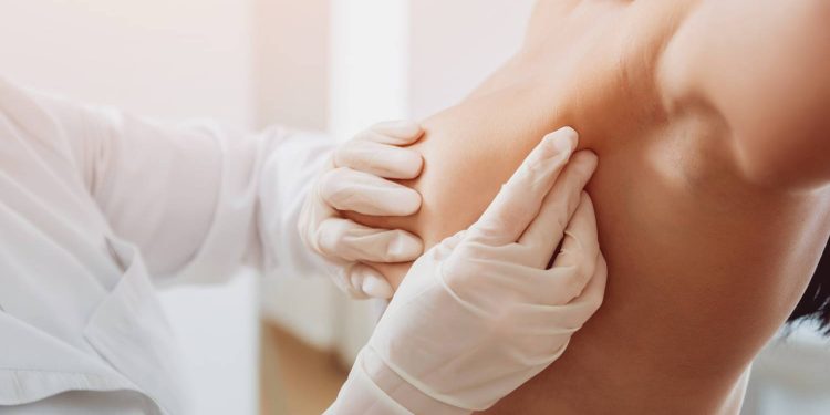 Il 54% delle donne con carcinoma mammario non ha utilizzato una o più terapie integrate