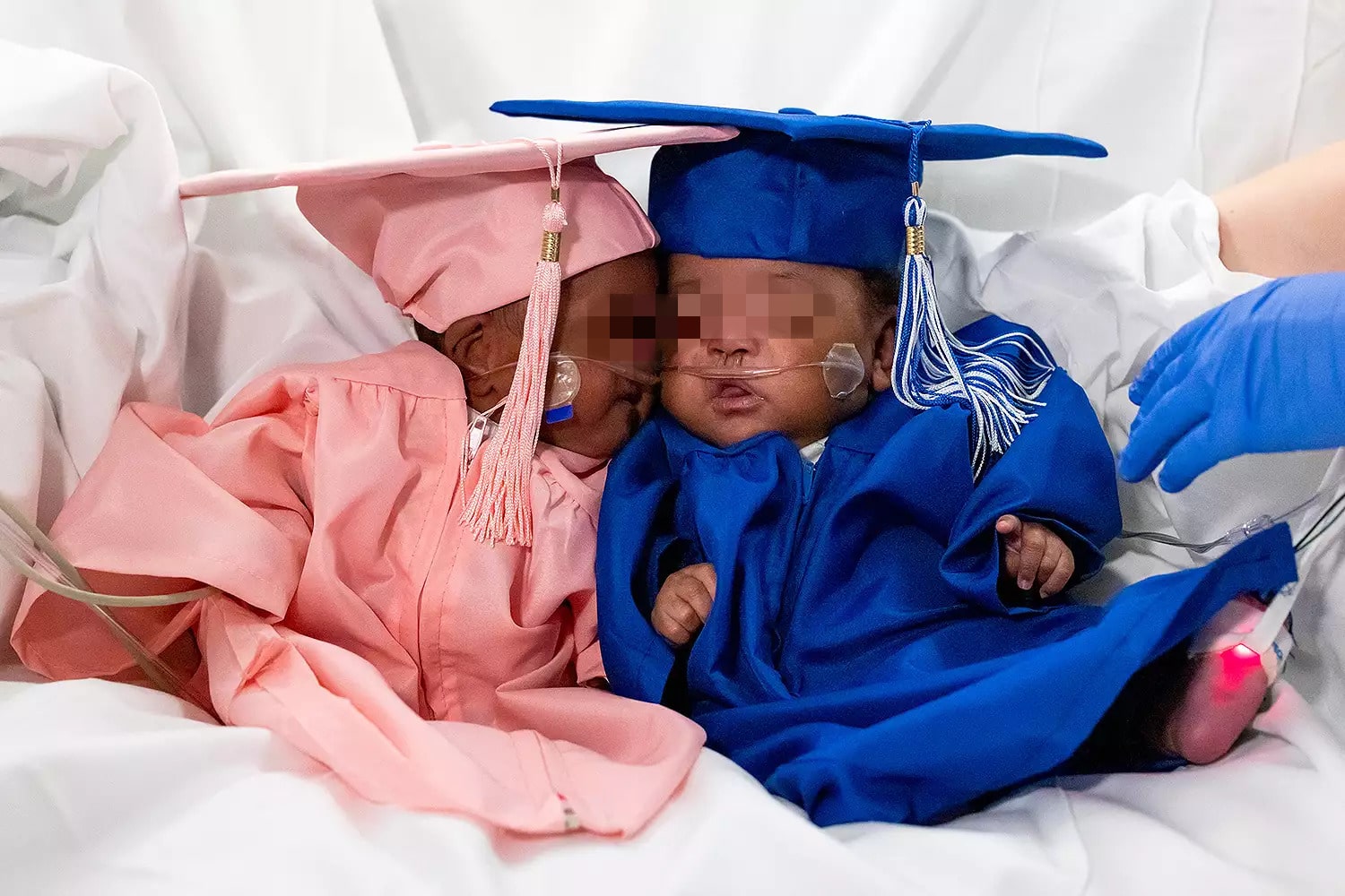 Nati a 22 settimane, i gemelli con l’abito e il tocco del “diploma” in ospedale